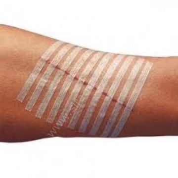 Steril Strip Steril Strip Lacivert
