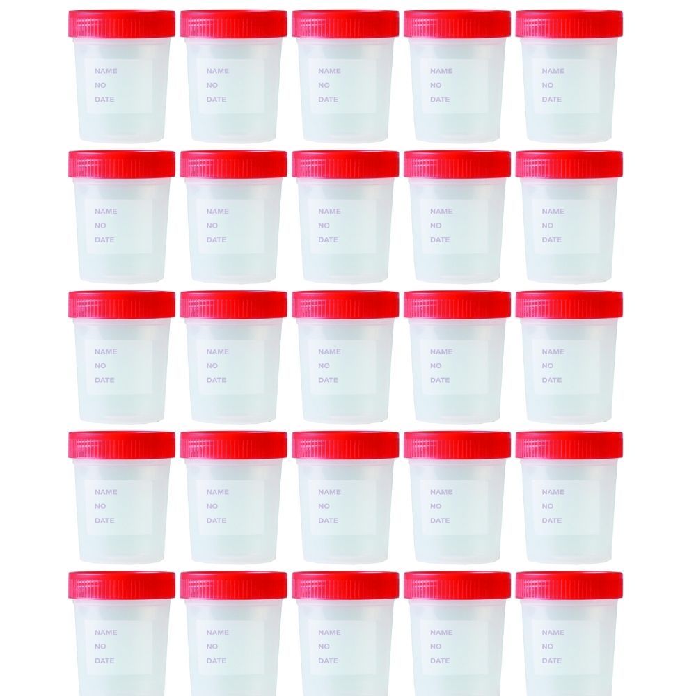 Numune Kabı 250 ml | 25 Adet | Steril Poşetli Numune Saklama Kabı