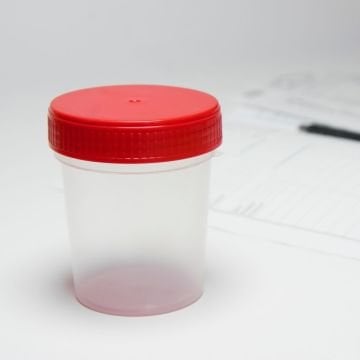 Numune Kabı 100 ml | 100 Adet | Steril Poşetli Numune Saklama Kabı